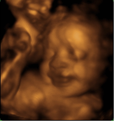 ultrasound_unborn_baby-2.jpg
